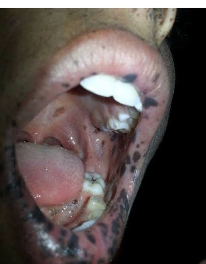 Identify the Condition