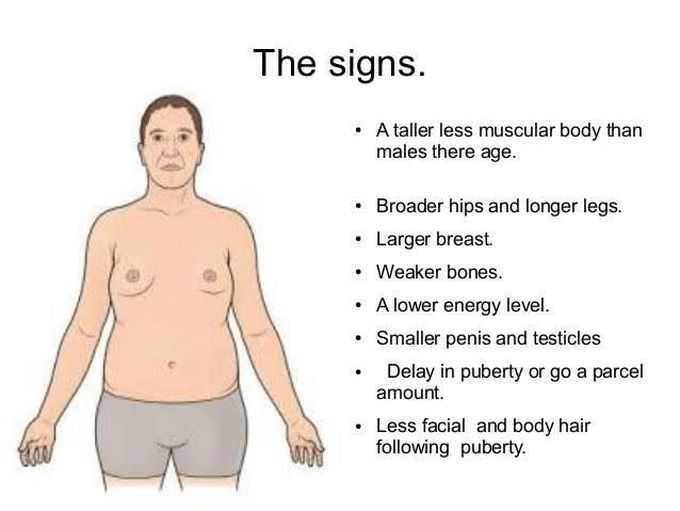 Klinefelter syndrome