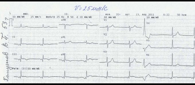 Does anyone knows the diagnosis for this case?