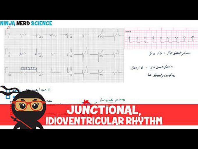 Junctional and Idioventricular rhythm
