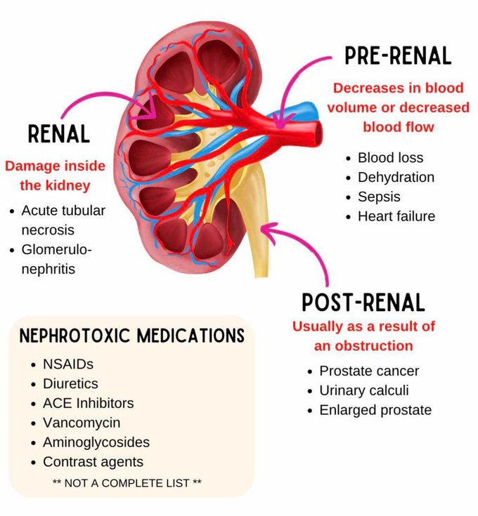 Acute Kidney Injury