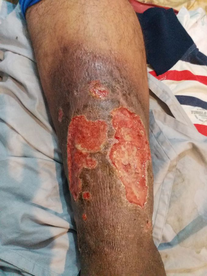 What is your Diagnosis?