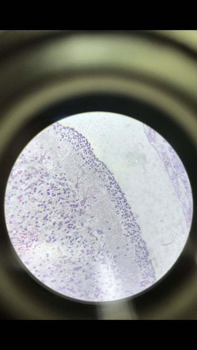Look at those Purkinje cells!!
