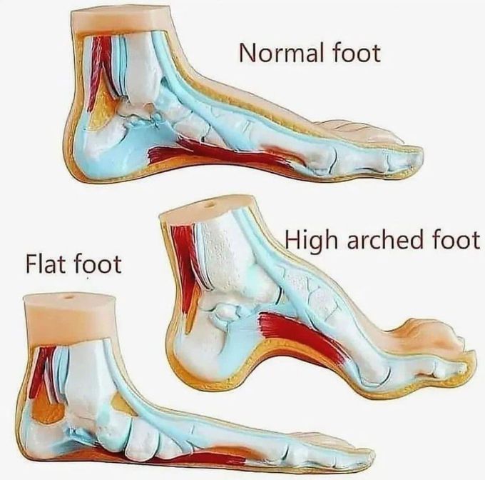 Types of Foot