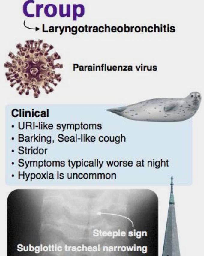 Croup
