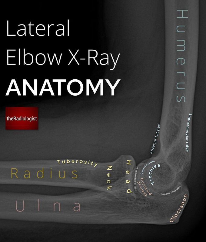 Upper Limb Anatomy V