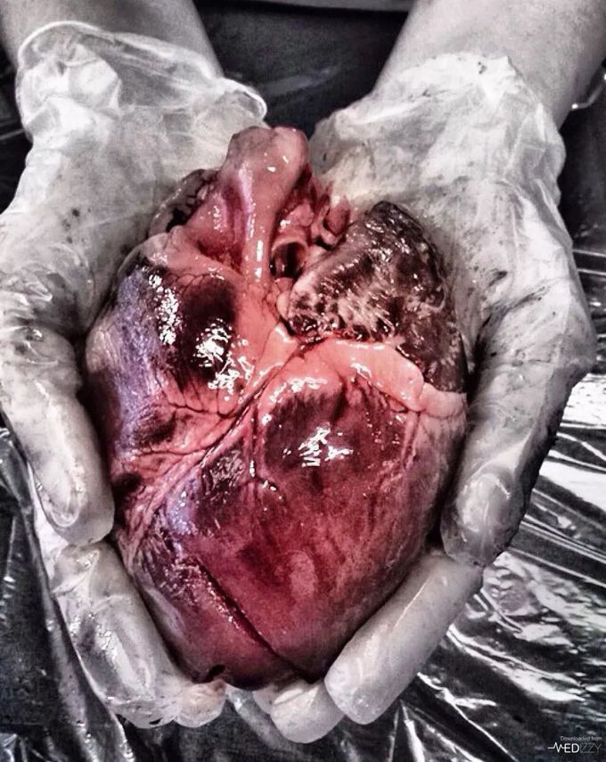 Appreciate your heart