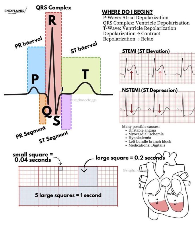 ECG Review II