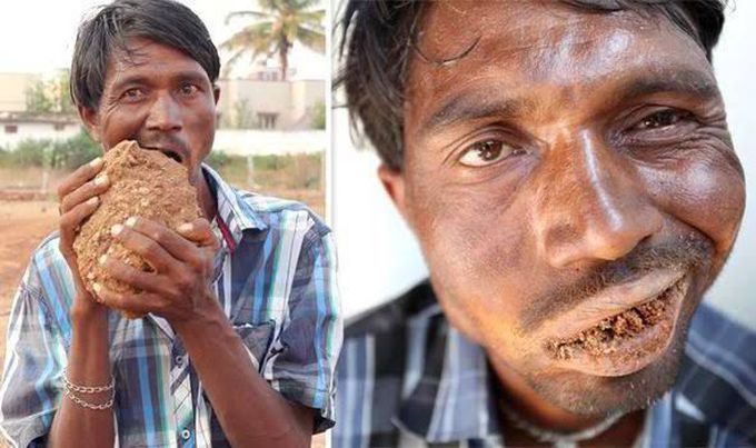 Its a disorder in which person chews and craves substances that have non nutritional value such as mud,. Clay, soil. Etc