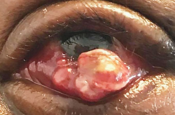 What is your diagnosis?