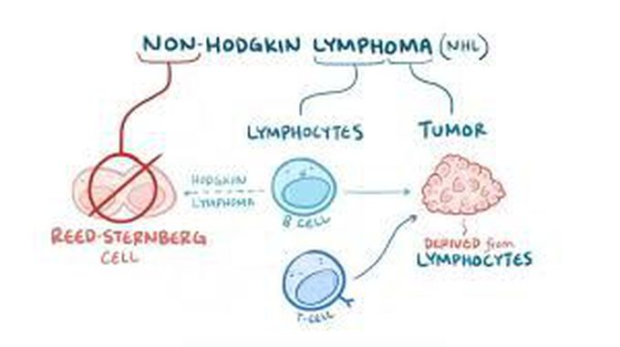 Non Hodgkin's lympnoma
