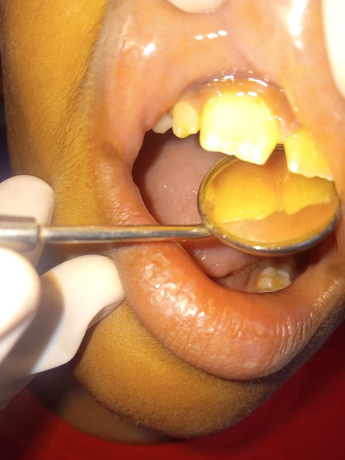 Identify the condition 💉💊