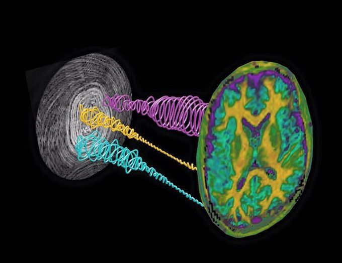 MRI fingerprinting!