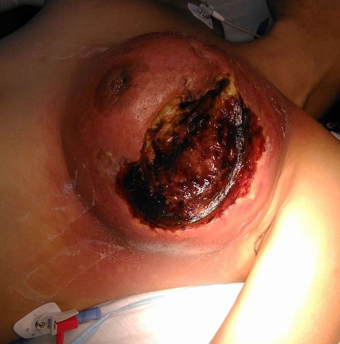 What is your diagnosis???