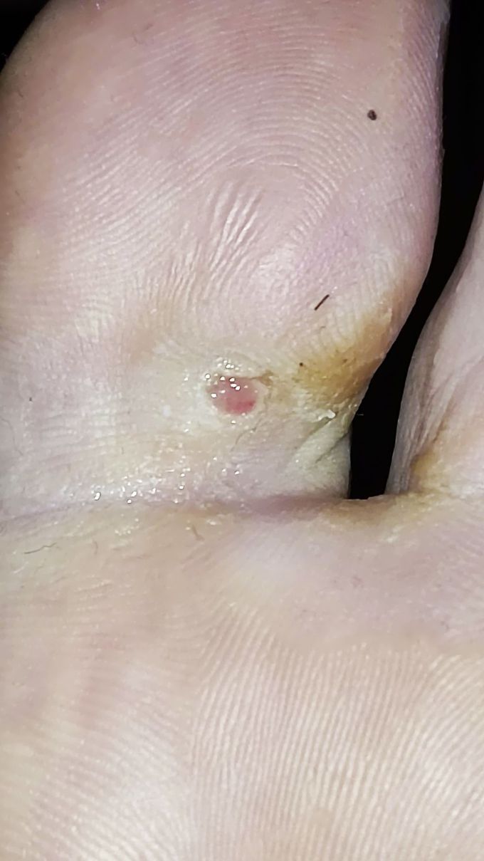 Strange red bubble?