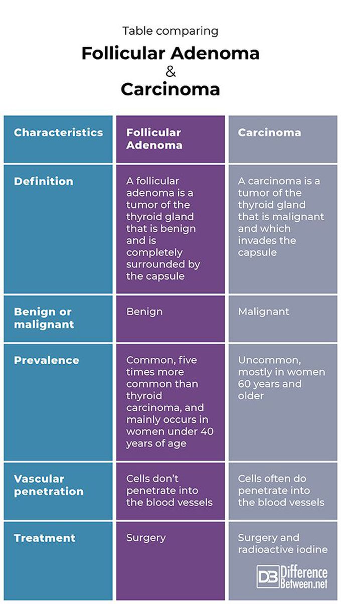 Thyroid Follicular Adenoma vs Thyroid Follicular Carcinoma