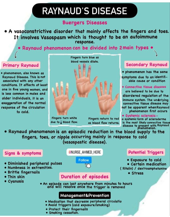 Raynaud's Disease