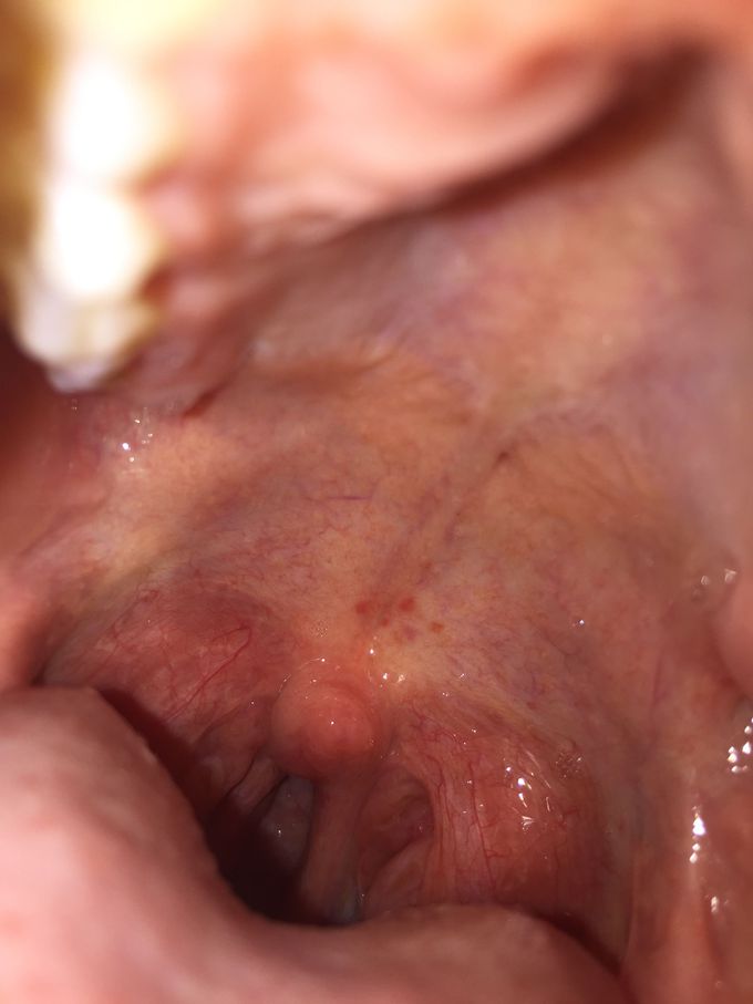 What is your diagnosis??