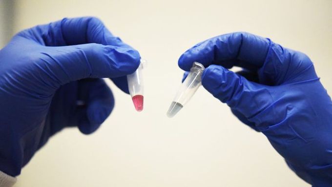 How ‘absolutely stunned’ scientists used gold to make a key cancer breakthrough