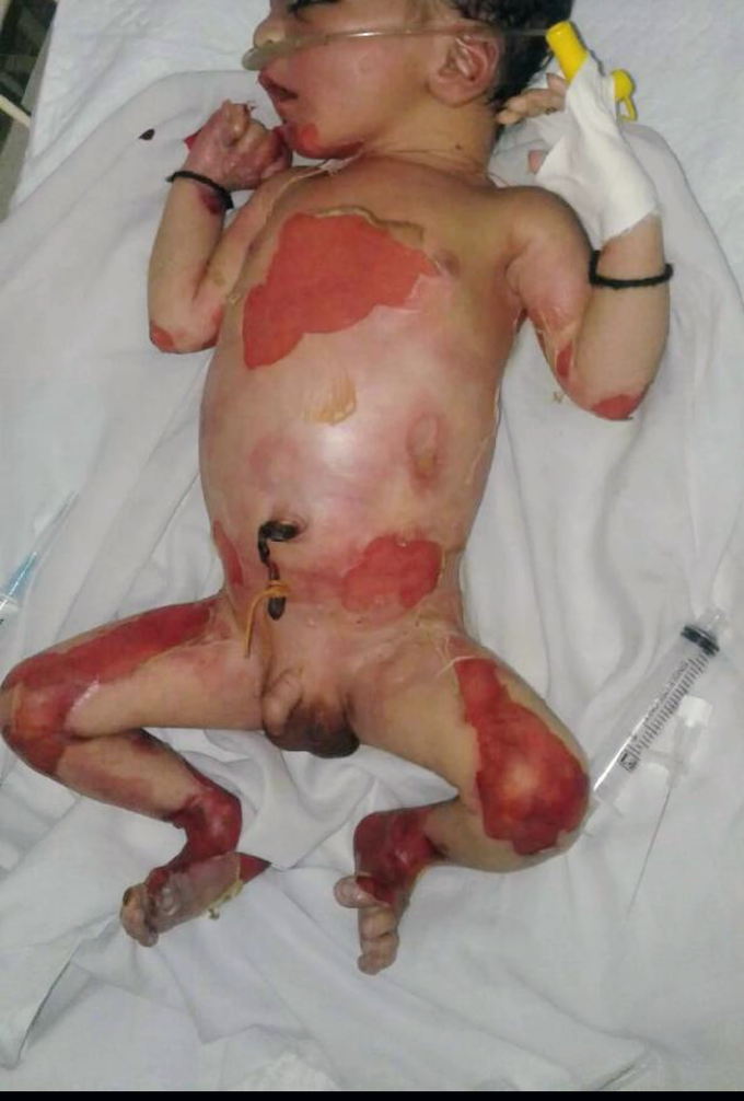 Diagnosis ??