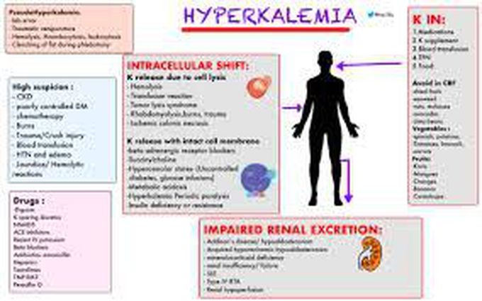 What is hyperkalemia