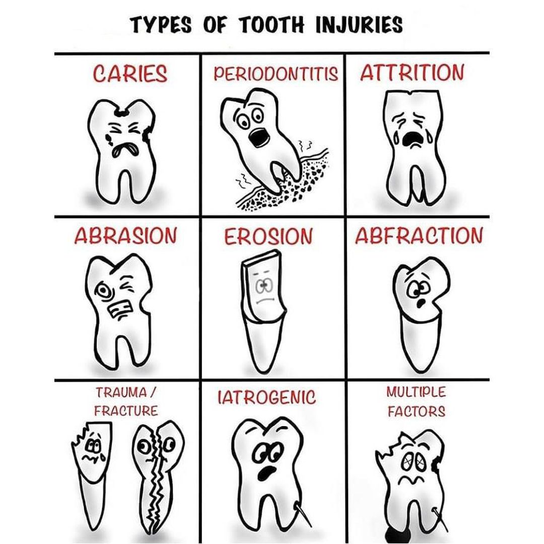 Type Of Tooth Injuries Medizzy