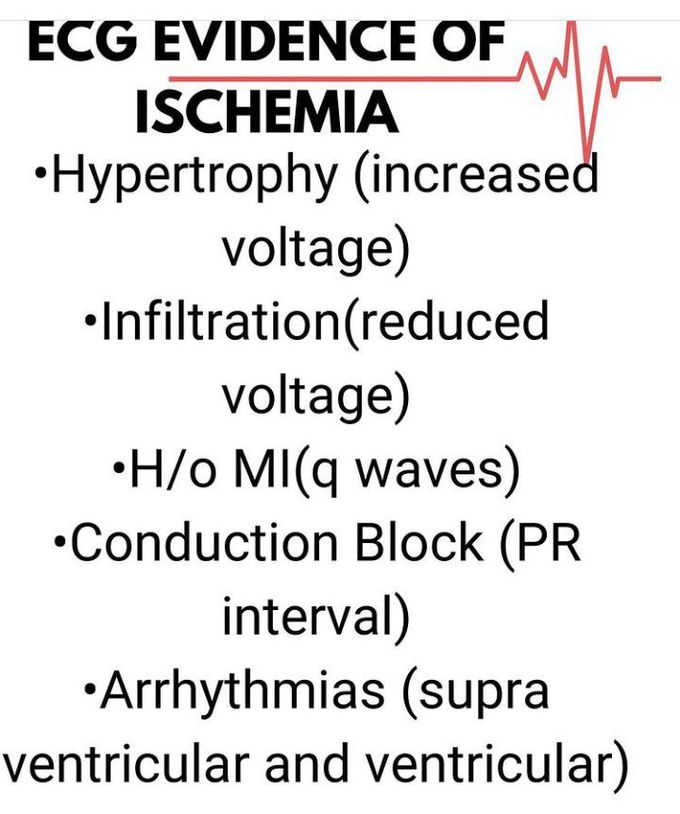 ECG Evidence of Ichemia
