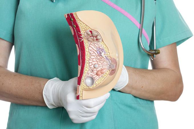Breast cancer: Bacterial deficiency linked with onset
