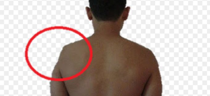 Diagnosis?