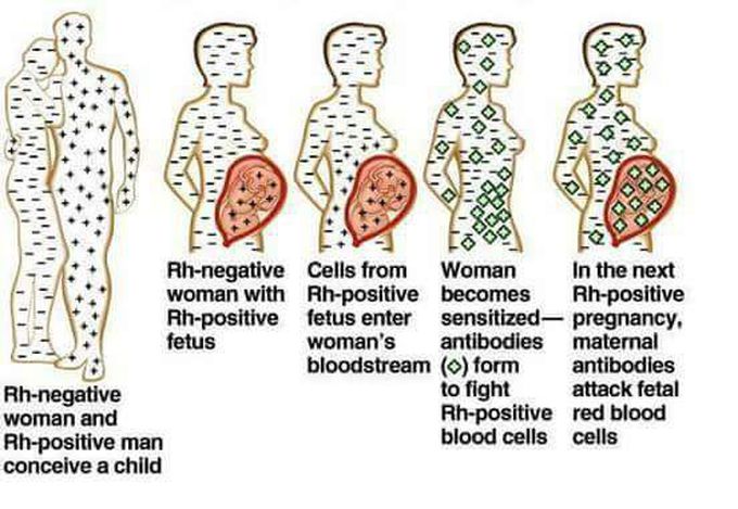 Importance of Rh factor ...