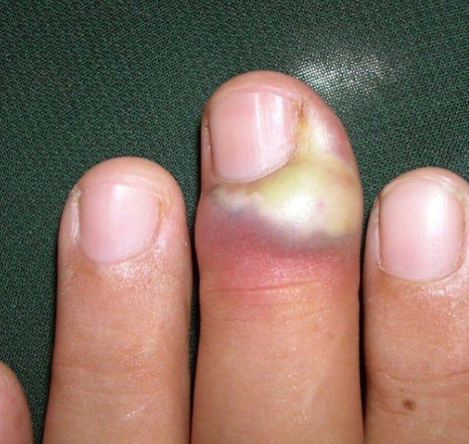 What is diagnosis???