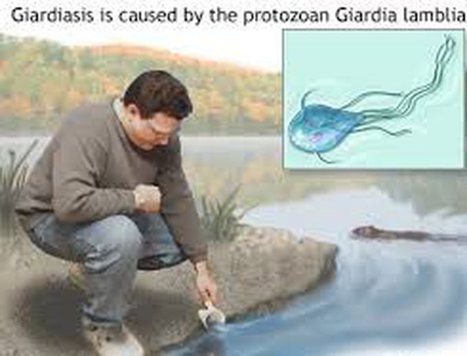 Giardiasis