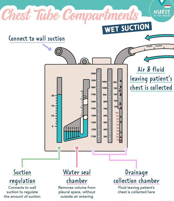 Chest Tube Compartments-Wet Suction