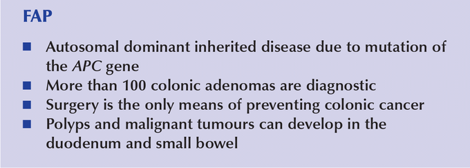 Familial adenomatous polyposis