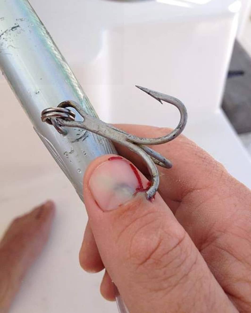 PDF) Fish-hook injuries: A risk for fishermen