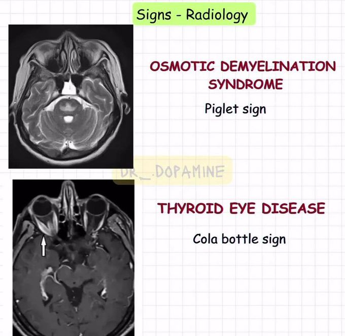 Radiology Review I - MEDizzy
