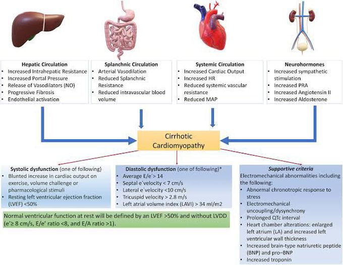 Cirrhotic Cardiomyopathy