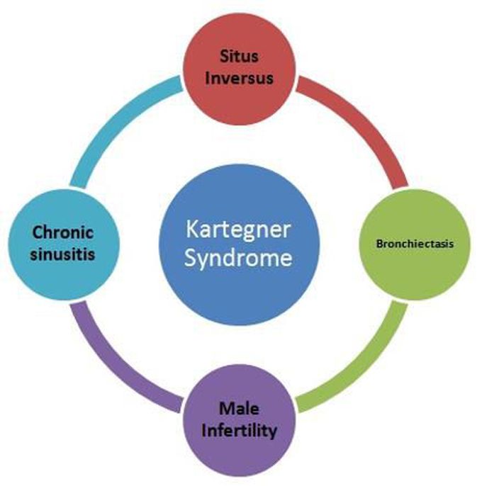 Cause of Kartagener's syndrome