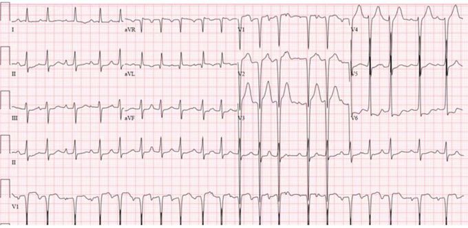 Ecg diagnosis - MEDizzy