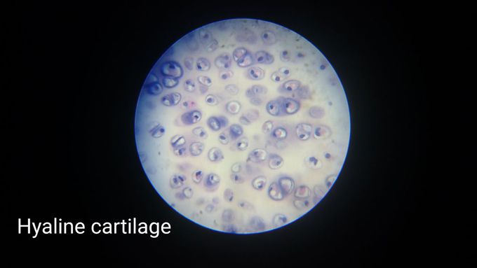 Hayline cartilage. 45x