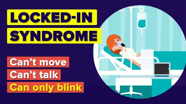 These are the symptoms of Locked in syndrome - MEDizzy