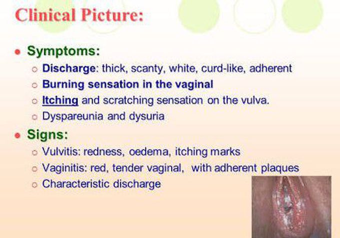 genital areas with burning