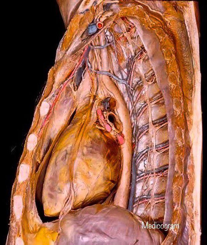 Very impressive dissection of the thorax, revealing all the relevant structures