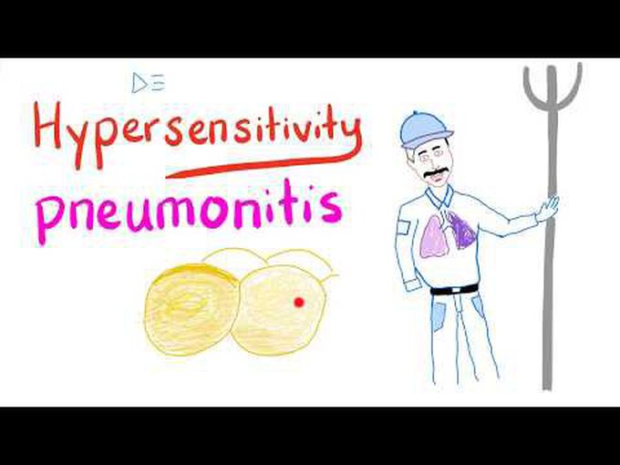Descriptive Pathology of Hypersensitivity Pneumonitis
