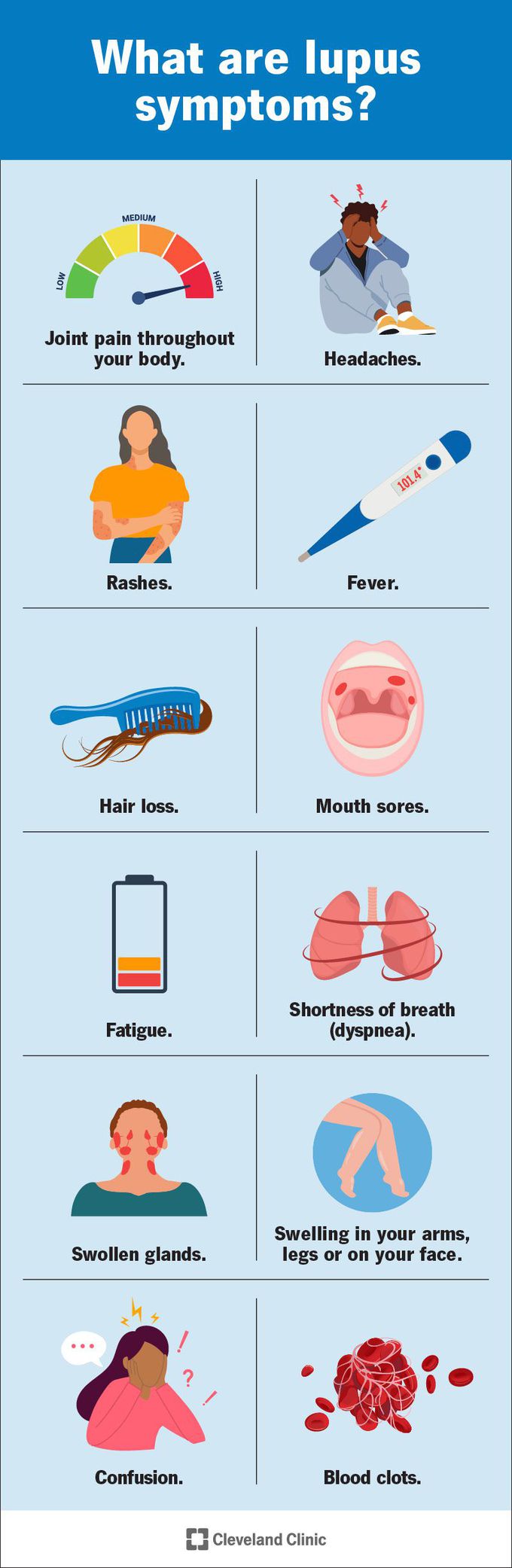 Causes and symptoms of SLE