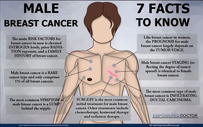 Male breast cancer