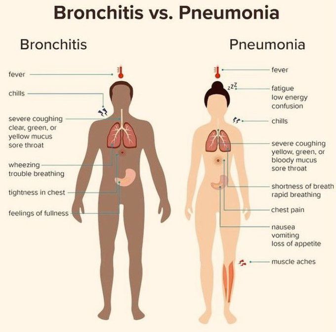 Bronchitis Vs Asthma