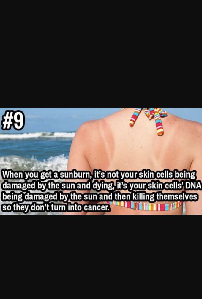 Skin carcinoma