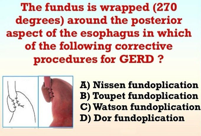 Identify the Procedure