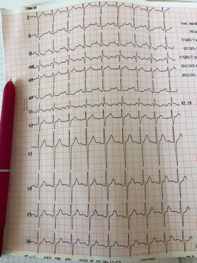 20 year old female came into A&E .. what dignosies would you do?